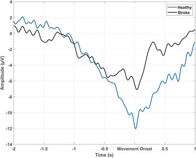 Electroencephalographic Recording of the Movement-Related Cortical Potential in Ecologically Valid Movements: A Scoping Review